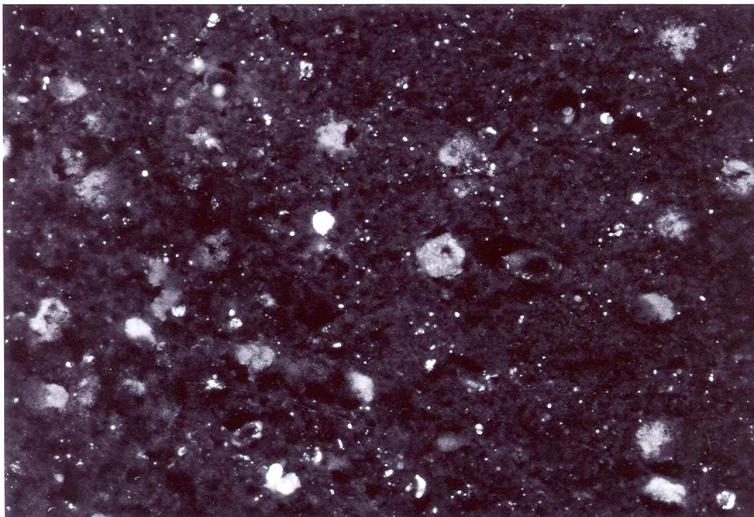 megfigyelhető a NRM-ban. Rövidítések: ir: immunreaktivitás, NRM: nucleus raphe magnus, SP: P-anyag 50. ábra.