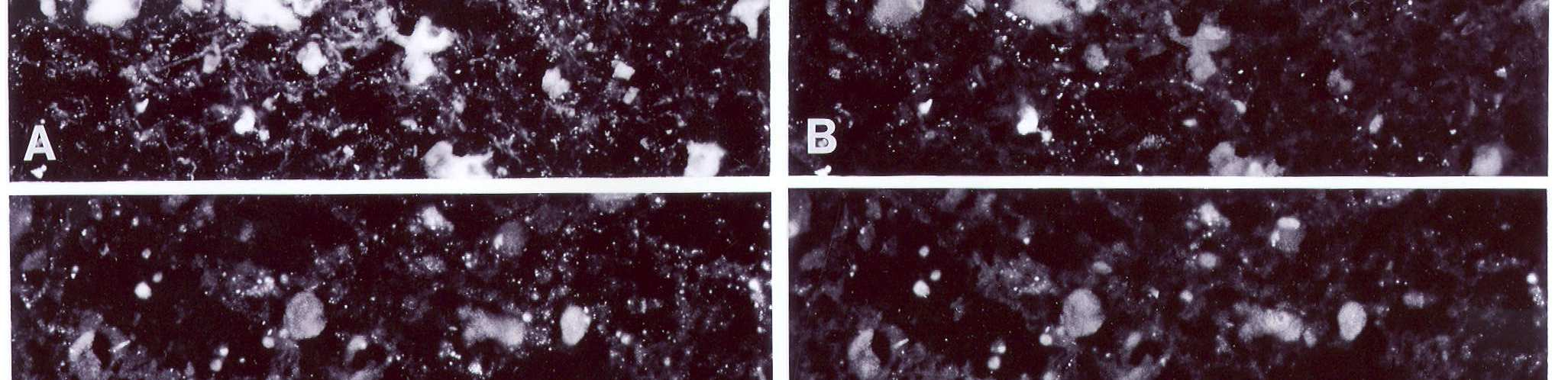 immunfestése a VMAT (A), a CGRP (B), a C-PON (C) és a CGRP (D)