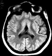 holoventriculus A.J.