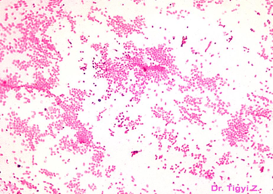 Gram (+) coccus