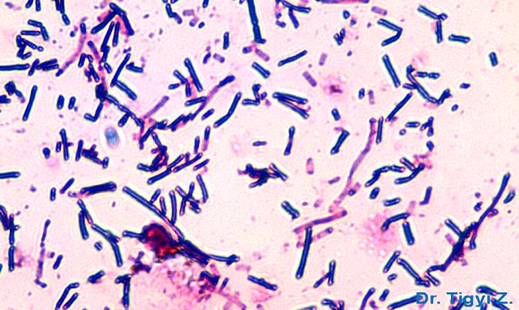 Gram-szerinti festés Bacillus cereus, Gram (+) pálca 48 órás tenyészetből, a nem Gram (+)-van