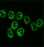 Anti-neutrophil citoplazmatikus antitest (ANCA) Döntően IgG típusú antitestek Etanolban