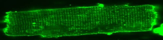 % of cells % of cells dc_509_12 A F 100 80 B 20 µm 60 40 D0 D1 D2 D3 D4 D5 20 0 C 0 20 40 60 80 100 T-tubule area (% of cell area) G 100 D 80 60 D0 Detubulated 40 E 20 0 0 20 40 60 80 100 T-tubule