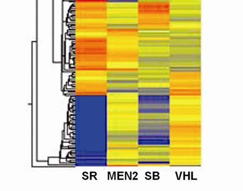 multiplex endokrin neoplasia 2-es típusához társuló