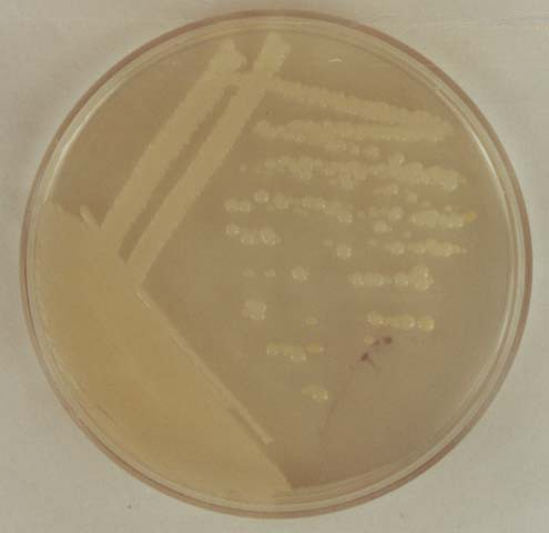 A tenyészet hársfavirág illatú, a telepek irizáló felszínûek 12. Klebsiella sp.