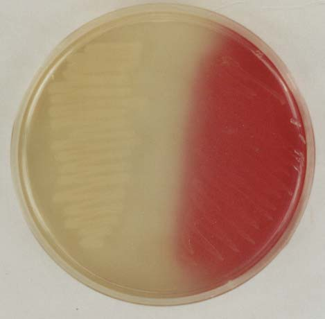 coli növekedését és a Proteus rajzását gátolja. 14. E. coli and Salmonella sp. on brilliant green medium E. coli és S.