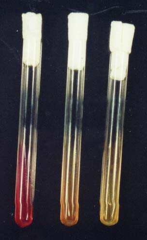 18. Christensen medium(sterile) and: - Urease+ - Urease- Christensen táptalaj (ureum,