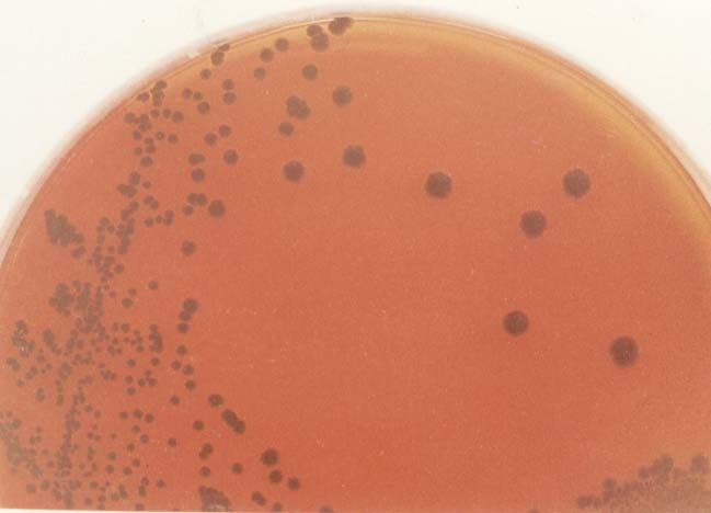 19. Corynebacterium diphtheriae on Clauberg (tellurite) and on Löffler medium Corynebacterium diphtheriae Clauberg