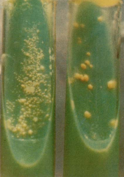 20. Mycobacterium tuberculosis on Löwenstein medium Mycobacterium tuberculosis Löwenstein-Jensen táptalajon: Tojást,