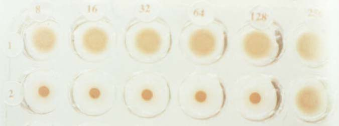 4. Influenzavirus hemagglutination (HA) and haemagglutination inhibition (HAI), and complement