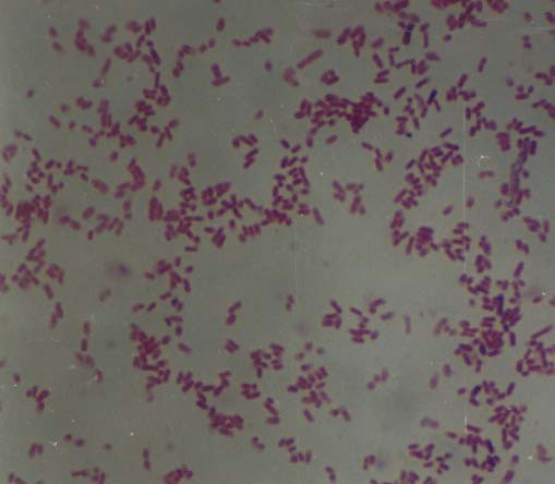 - E. coli Escherichia coli - Gram festés