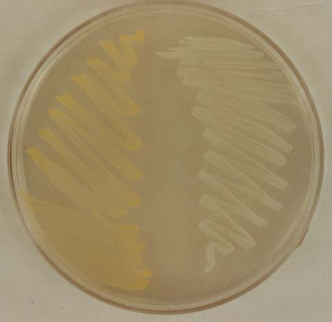 II. Cultures (theoretical background, description) 1. Staphylococcus aureus, S.