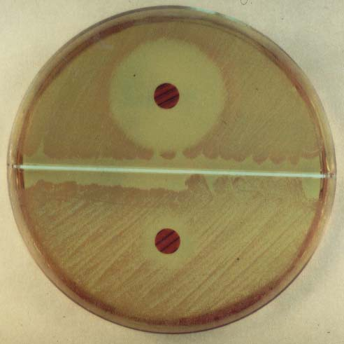 nincs 4. S. saprophyticus and S.