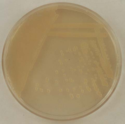 on blood agar plate and eosine-methyleneblue medium Proteus vulgaris véresagar