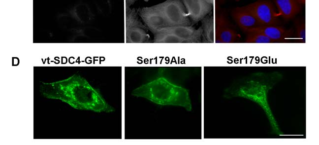 A GFP nélküli, vad típusú syndecan-4 (vt-sdc4)-et túltermelő vonalban sem érte el a syndecan-4 mennyisége a C2/7 myoblastok endogén syndecan-4 szintjét (11. ábra A).