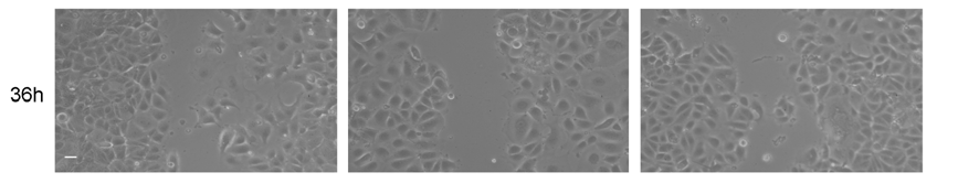 Ezt követően fáziskontraszt mikroszkóppal sorozatfelvételeket készítettünk a vad és mutáns syndecan-4-et expresszáló sejtekről,