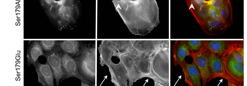 PMA kezelés hatására aktin stressz-szálak alakultak ki a vad típusú és a Ser179Ala mutáns syndecan-4-et expresszáló sejtekben (A, B2; fehér nyílhegyek).