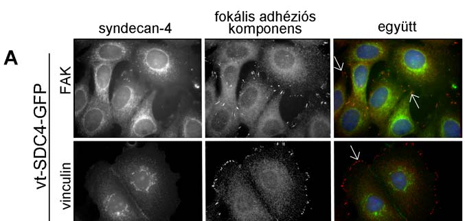 18. ábra. A syndecan-4 Ser179 mutációk hatása a fokális adhéziókra.