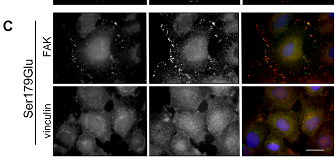 A Ser179Ala sejtekben kisebb méretű fokális komplexeket láttunk, melyekben a FAK és vinculin is kimutatható volt (B, nyílhegyek).