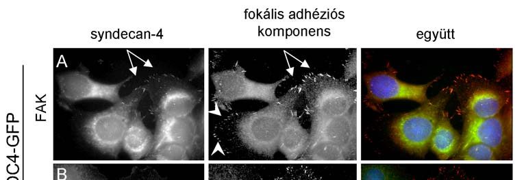 19. ábra. PMA hatása a fokális adhéziók szerveződésére.