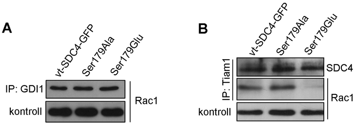 A Tiam1 egy Rac specifikus guanin nukleotid kicserélődési faktor, amely elősegíti a GTP-áz inaktív formájából az aktív, GTP-t kötő forma kialakulását.