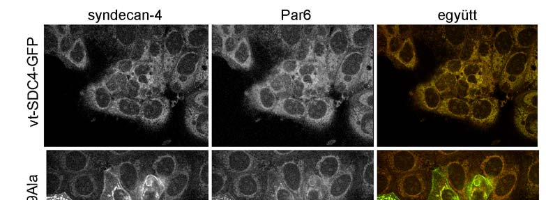 Mivel az epithel sejtek polaritását kialakító, a Par polaritás komplexhez tartozó Par6 és a syndecan-4 ko-immunprecipitálódtak, így a továbbiakban megvizsgáltuk a Par6 sejten belüli eloszlását a