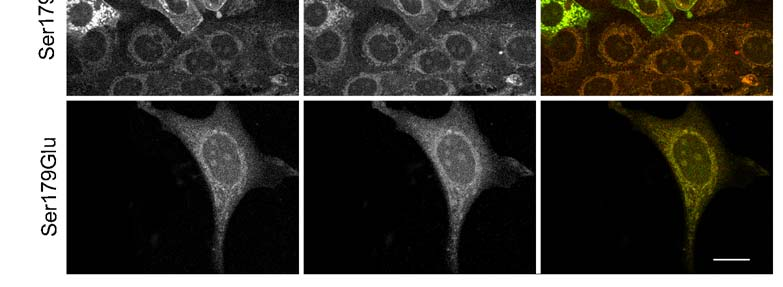 A syndecan-4-gfp fúziós fehérjék (zöld) és a Par6 (piros) eloszlását konfokális mikroszkóppal vizsgáltuk.