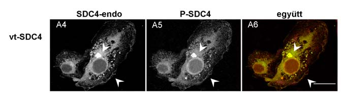 Kísérleteinkben a GFP-vel nem fúzionált vad típusú syndecan-4 (vt-sdc4)-et stabilan expresszáló MCF-7 sejtekben megvizsgáltuk a syndecan-4 viszonyát a mikrotubuláris rendszerhez, főként az