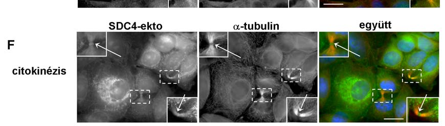 syndecan-4 a mikrotubulus organizáló