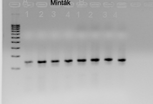 A B 9. ábra. A. Matrilin-2 real-time RT-PCR termékek agaróz gélen. B. A termékek olvadáspont analízise. 4.5.8.