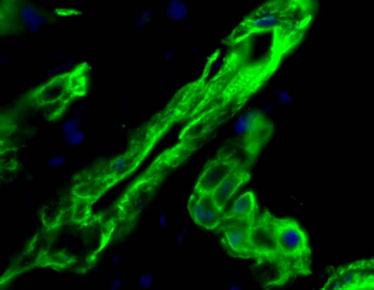 A B 15. ábra. HE festés AAF/PH kezelést követő regenerálódó patkány máj metszeten. A. Ovális sejt proliferációban gazdag portális tér (nyilak), 200 x; B.