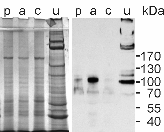 5.2. Matrilin-2 fehérje expresszió detektálása AAF/PH kezelést követően Western blot technikával Azonos mennyiségű normál patkány, PH kezelt és AAF/PH kezelt patkány májszövet homogenizátumot 4-8%-os