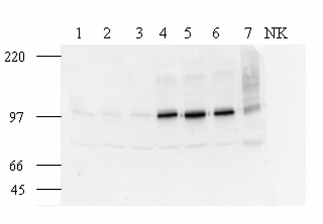 20. ábra. Matrilin-2 fehérje expresszió detektálása Western blot technikával. 1, 2, 3 normál májak; 4, 5, 6 - AAF/PH kezelt minták a PH-t követő 9, 11, és 13.