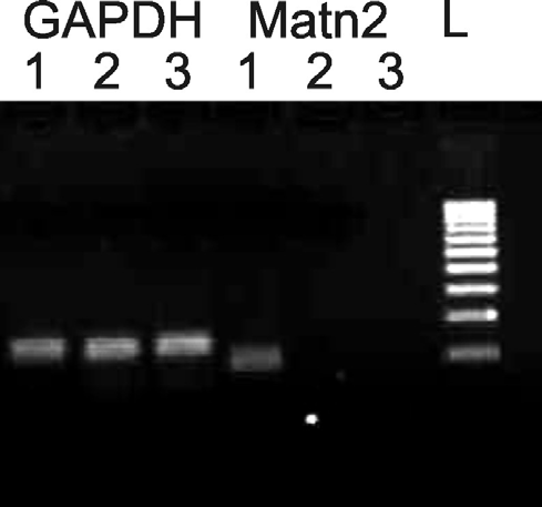 5.4. Matrilin-2 expresszió vizsgálata real-time RT-PCR analízissel Annak igazolására, hogy a matrilin-2-t valóban az ovális sejtek termelik a SE II.