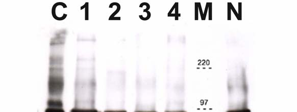 fehérjekivonatot használtunk (30. ábra). Az ábrán jól látható, hogy a matrilin-2 fehérjére jellemző nagyobb molekulasúlyú oligomer frakció is jelen volt a humán májakban.