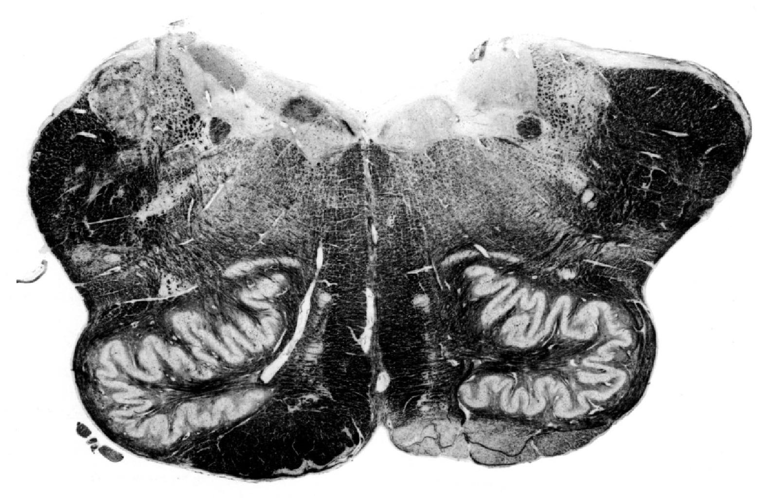 Medulla