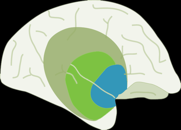 Ischaemic area + 1h. + 3h. + 12h. + 24h. Idő Adapted from: Donnan et al.