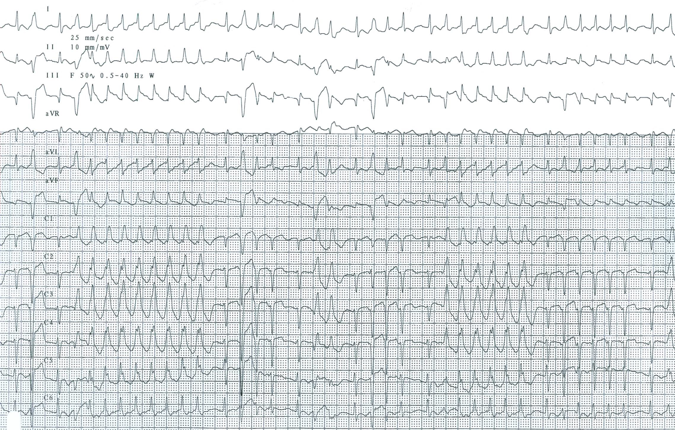 14/c Pitvari