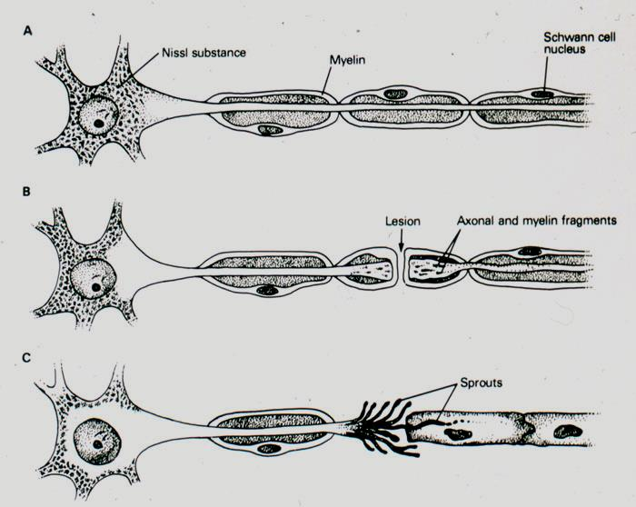Sarjadzás (sprout) PNS axonon Sérülésre adott reakció