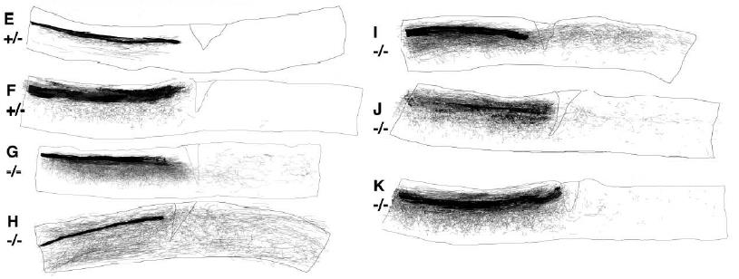 Adding these antibodies to culture allows axon outgrowth on myelin.