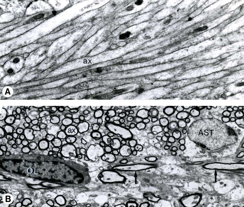 AGYI FEHÉRÁLLOMÁNY: MYELIN-NÉLKÜLI (A) és MYELINES