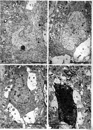 A NEURON SÉRÜLÉKENY: