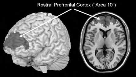 PM lokalizációja Brodmann area 10 = rostral prefrontal cortex = anterior prefrontal cortex = frontopolar cortex =
