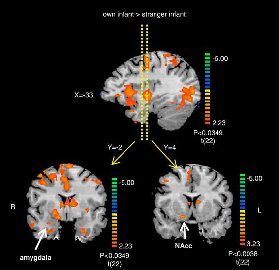 A GONDOSKODÓ HUMÁN SZÜLŐK AGYÁBAN BEKÖVETKEZŐ VÁLTOZÁSOK: fmri KÍSÉRLETEK Shir Atzil, Talma Hendler and Ruth Feldman (2011) Specifying the