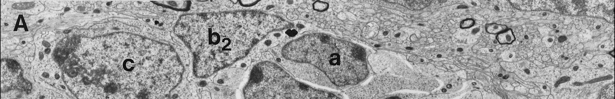 3. ábra A szubventrikuláris zónában található sejttípusok elektronmikroszkópos képe Doetsch és mtsai 1997 Journal of Neuroscience Jelenlegi ismereteink szerint a B-sejtek