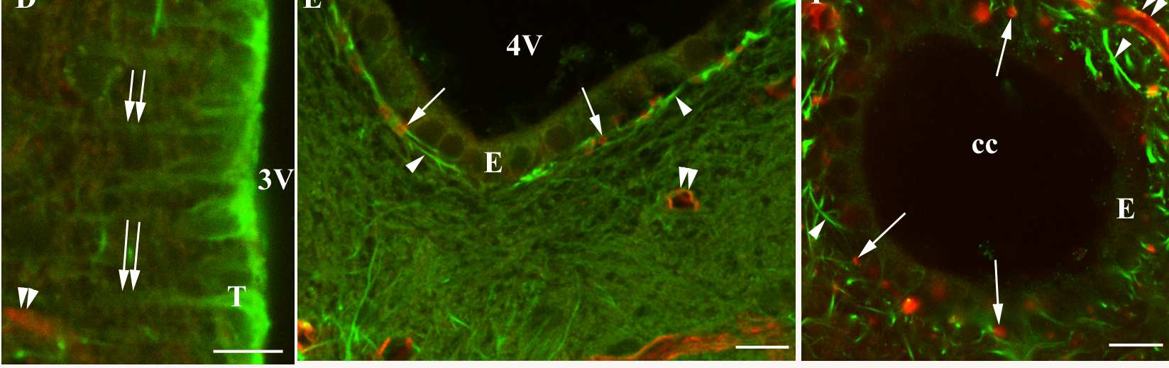 C: A harmadik kamra (3V) fala a határvonal mentén (csillag), ahol az ependimociták (E) felváltódnak tanicitákkal (T). Kettős nyíl-taniciták nyúlványai.