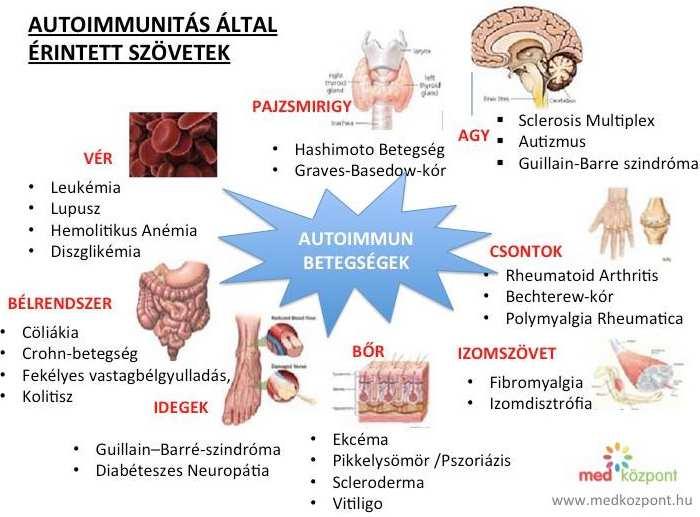 Michael Goldberg MINDD - Metabolikus Immuno-Neurológiai Emésztési Zavarok 4A-s zavarok: