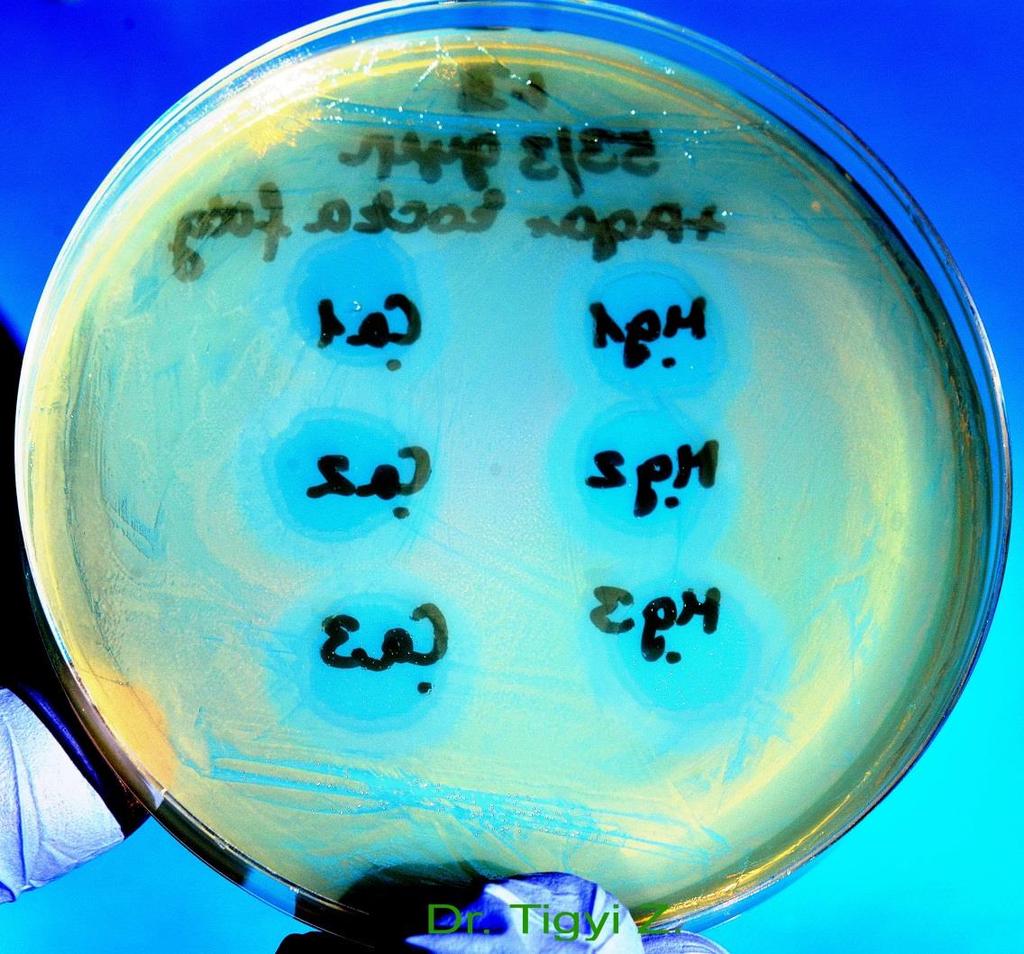 typing of Staphylococcus aureus