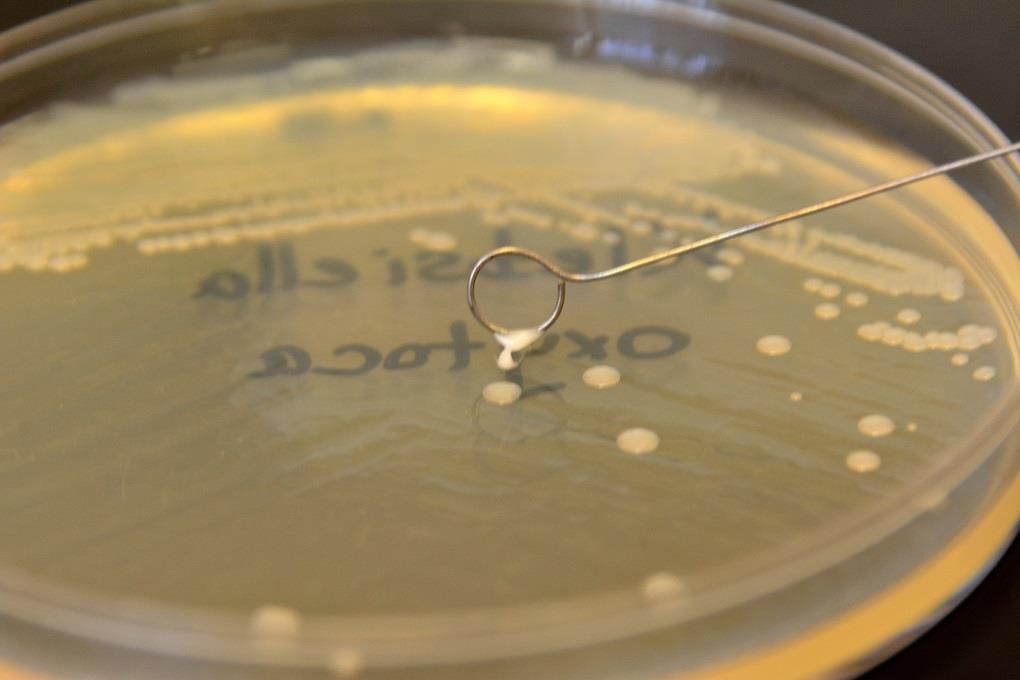 PREPARATION OF BACTERIAL SMEAR 3.