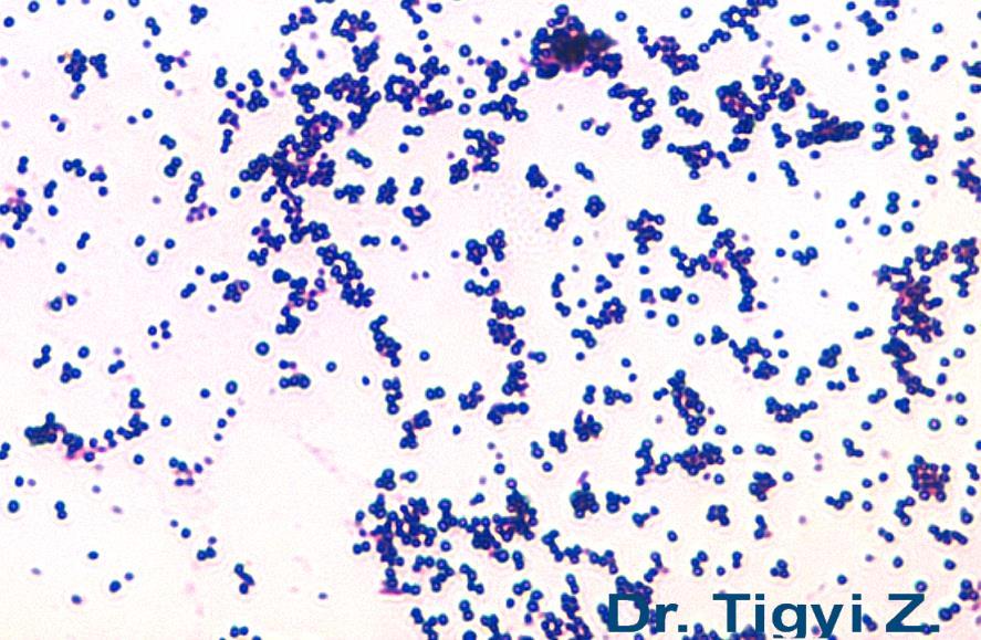 BACTERIAL SMEARS STAINED